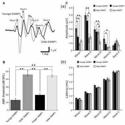Salicylate-Induced Suppression of Electrically Driven Activity in Brain Slices from the Auditory Cortex of Aging Mice